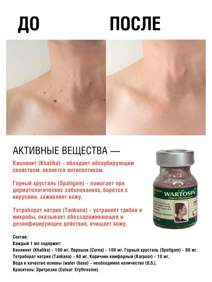 Вартозин Wart Remover от папиллом и бородавок Wartosin купить по цене 352 ₽  в интернет-магазине Wildberries | 140095557