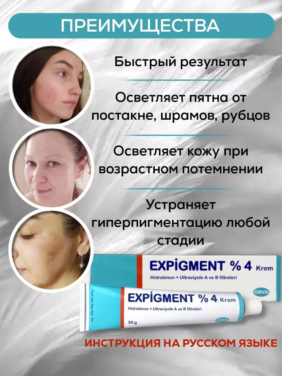 Отбеливающий крем от пигментных пятен веснушек Expigment 4% ORVA купить в  интернет-магазине Wildberries | 143280565