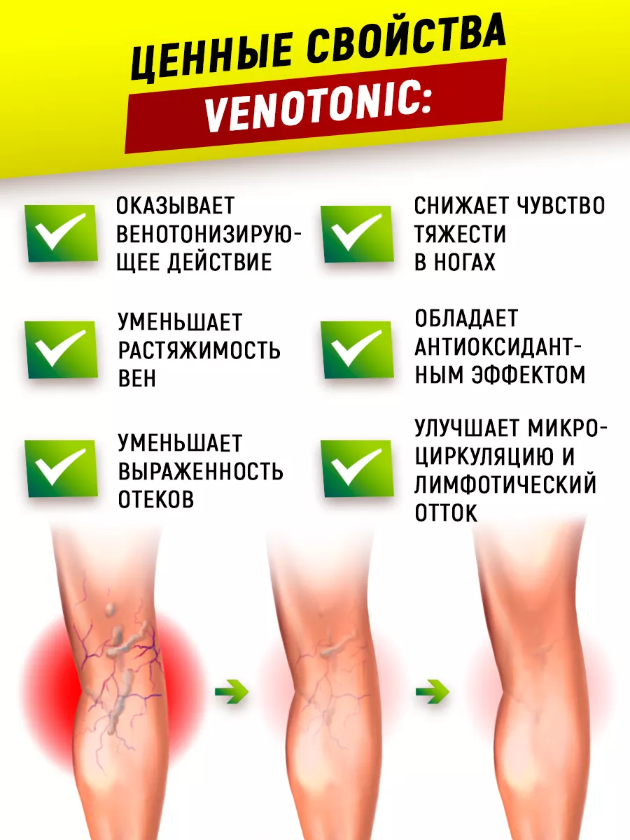 Таблетки от варикоза Венотоник от отеков ног ATech nutrition купить по цене  438 ₽ в интернет-магазине Wildberries | 143510535