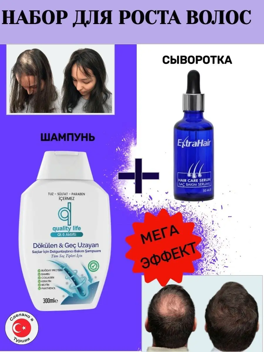 Extra Hair для роста волос от облысения и выпадения Extra HairD купить по  цене 0 ₽ в интернет-магазине Wildberries | 144869528