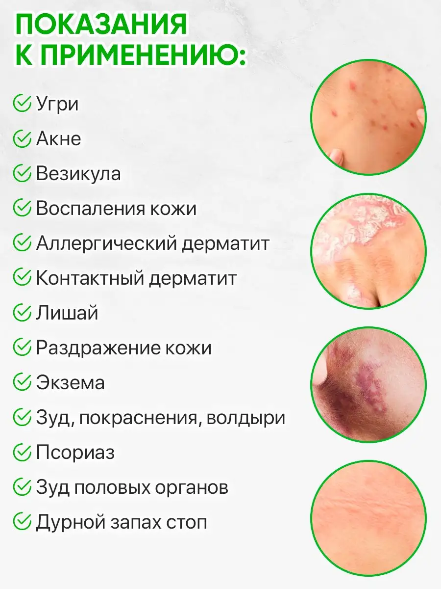 Мазь СЯО ГУАН (акне, дерматит, лишай, экзема) 1 шт 15г 4HEALTH купить по  цене 38 300 сум в интернет-магазине Wildberries в Узбекистане | 151222945