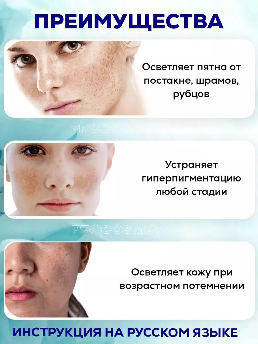 Экспигмент отбеливающий крем для лица Expigment 4% Expigment Turkey купить  в интернет-магазине Wildberries | 152682612